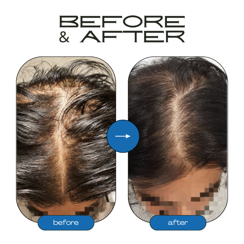 Rosemary Hair Growth Roll-On Serum