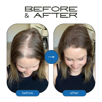 Rosemary Hair Growth Roll-On Serum