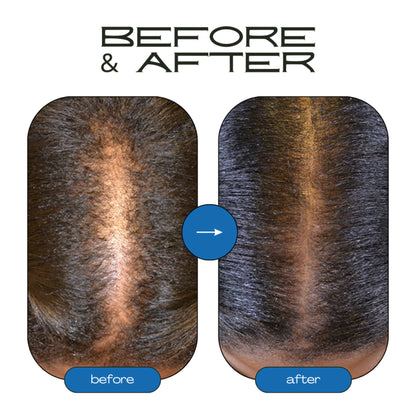 Rosemary Hair Growth Roll-On Serum