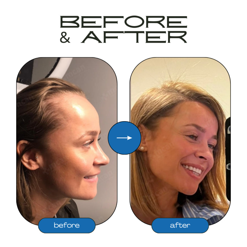 Rosemary Hair Growth Roll-On Serum