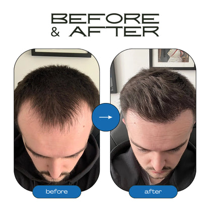 Rosemary Hair Growth Roll-On Serum