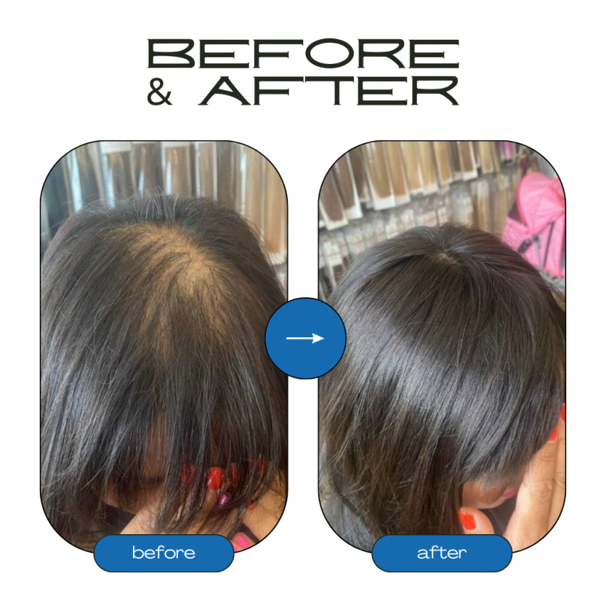 Rosemary Hair Growth Roll-On Serum