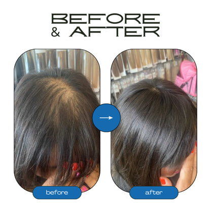 Rosemary Hair Growth Roll-On Serum