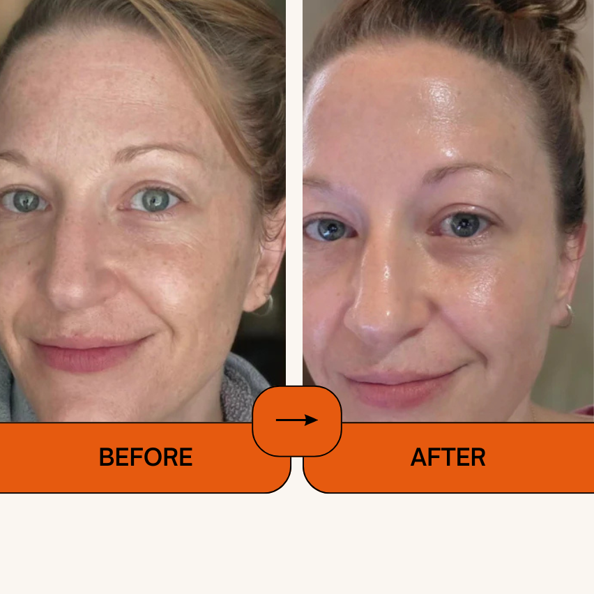 Kojic Acid Turmeric Face Spray