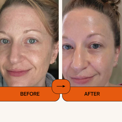 Kojic Acid Turmeric Face Spray