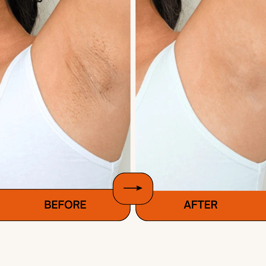 Kojic Acid Turmeric Face Spray