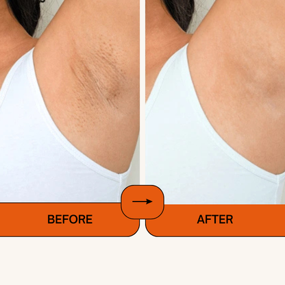 Kojic Acid Turmeric Face Spray