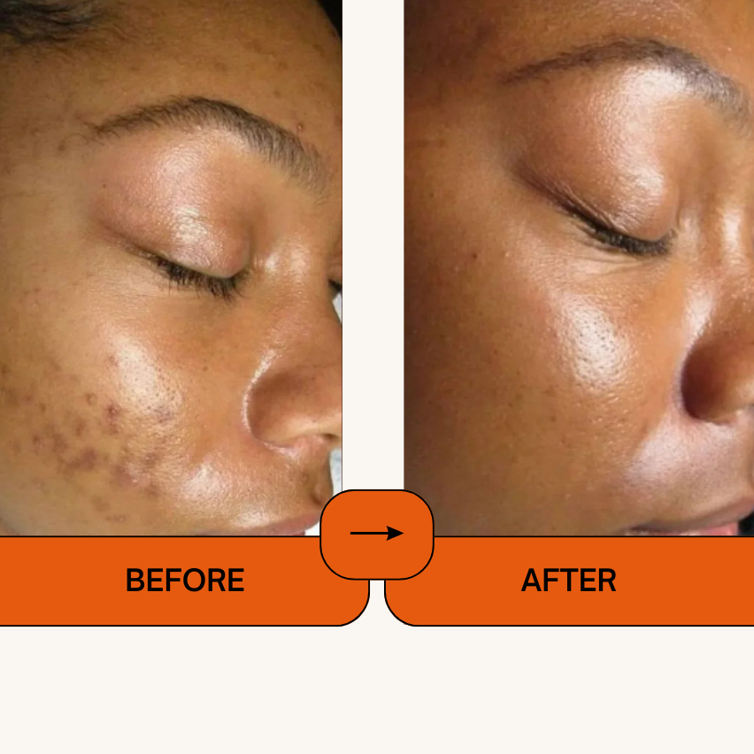 Kojic Acid Turmeric Face Spray