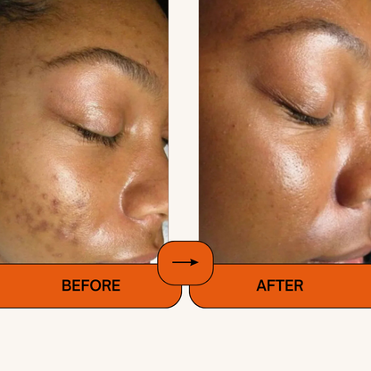 Kojic Acid Turmeric Face Spray